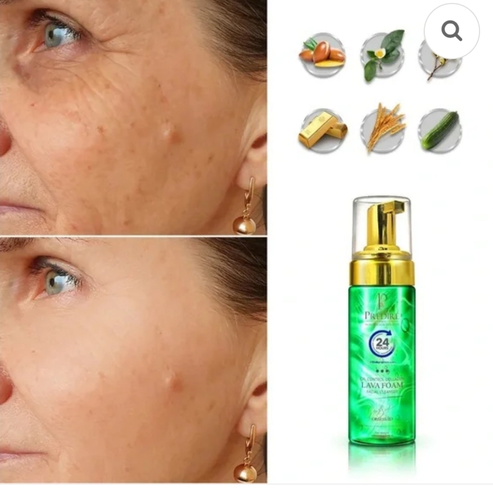 New Predier Oil Control Lava Foam Facial Cleaner w Collagen&Stem Cell Technology - Picture 2 of 3